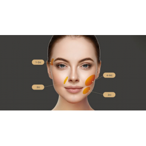 Etrebelle 200 mg/vial PLA+HA Hybrid Filler Korea Etrebelle 200 mg/vial PLA+HA Hybrid Filler Korea