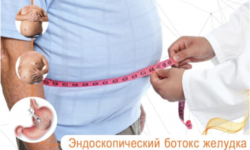 Unusual Weight Loss Method: Botulinum Toxin Injections in the Stomach