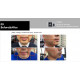 V-Sol lipolysis solution for face and body 10 ml *5 vial/ box S.Korea 