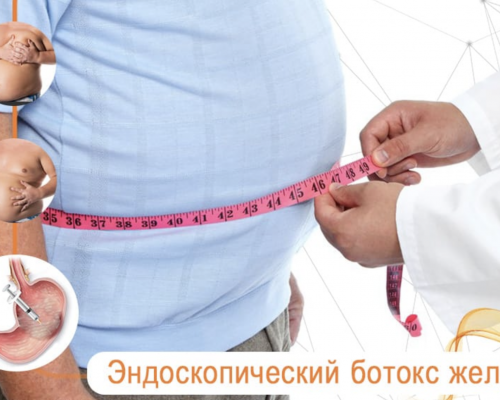 Unusual Weight Loss Method: Botulinum Toxin Injections in the Stomach